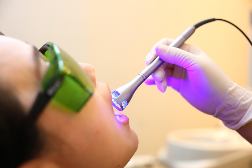 いびきレーザー治療ナイトレーズの治療風景